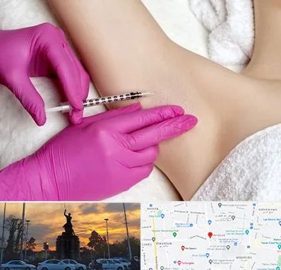 تزریق بوتاکس زیر بغل در میدان حر 