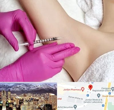 تزریق بوتاکس زیر بغل در جردن 