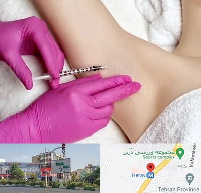 تزریق بوتاکس زیر بغل در هروی 