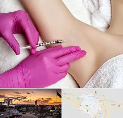 تزریق بوتاکس زیر بغل در قوچان