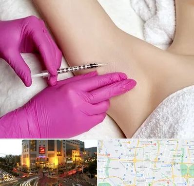 تزریق بوتاکس زیر بغل در جنت آباد تهران 