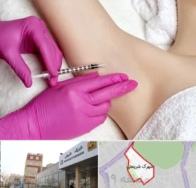 تزریق بوتاکس زیر بغل در شهرک شریعتی