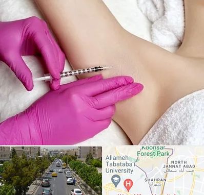 تزریق بوتاکس زیر بغل در شهران 