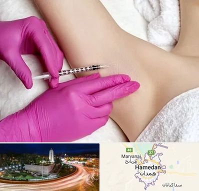 تزریق بوتاکس زیر بغل در همدان