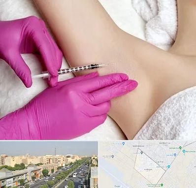 تزریق بوتاکس زیر بغل در کیانمهر کرج