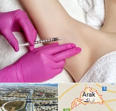تزریق بوتاکس زیر بغل در اراک
