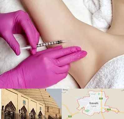 تزریق بوتاکس زیر بغل در ساوه