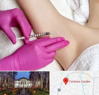 تزریق بوتاکس زیر بغل در باغ فردوس