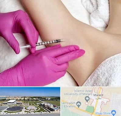 تزریق بوتاکس زیر بغل در ملارد