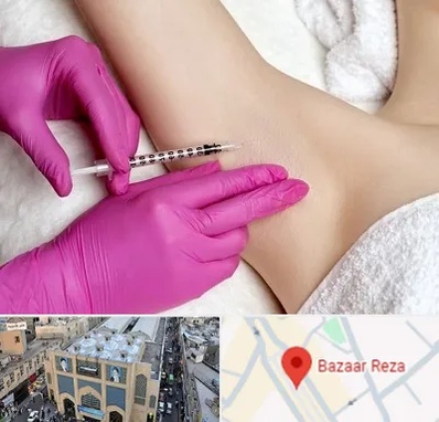 تزریق بوتاکس زیر بغل در بازار رضا مشهد