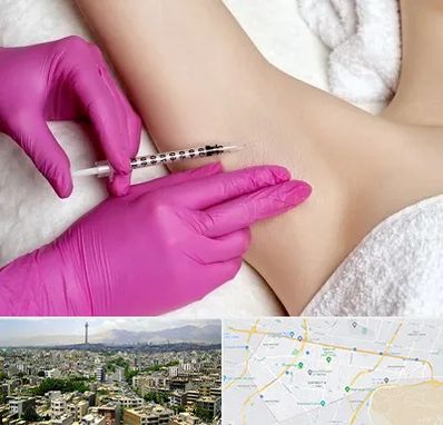 تزریق بوتاکس زیر بغل در منطقه 8 تهران 