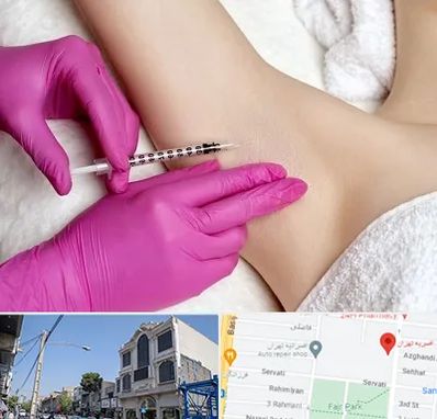 تزریق بوتاکس زیر بغل در افسریه 