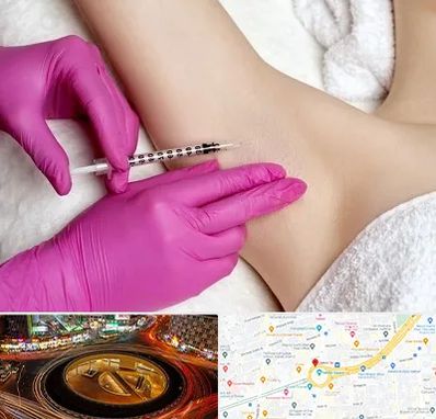 تزریق بوتاکس زیر بغل در میدان ولیعصر 