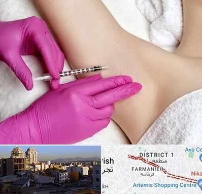 تزریق بوتاکس زیر بغل در فرمانیه 