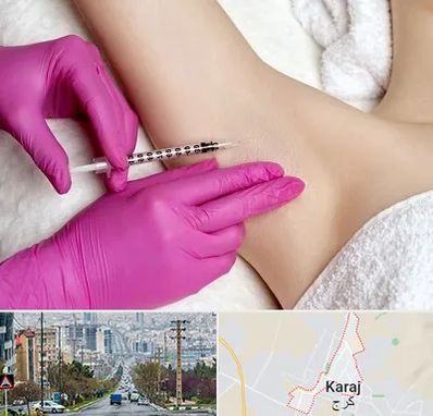 تزریق بوتاکس زیر بغل در گوهردشت کرج 