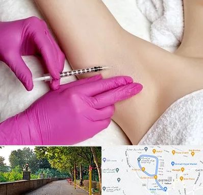 تزریق بوتاکس زیر بغل در بلوار گیلان رشت