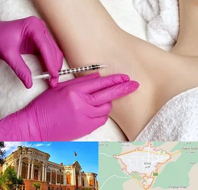 تزریق بوتاکس زیر بغل در خوی