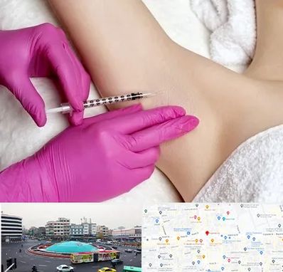 تزریق بوتاکس زیر بغل در میدان انقلاب 