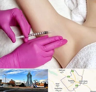 تزریق بوتاکس زیر بغل در تایباد