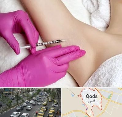 تزریق بوتاکس زیر بغل در شهر قدس