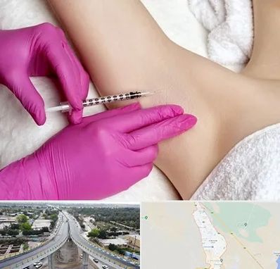 تزریق بوتاکس زیر بغل در اندیمشک