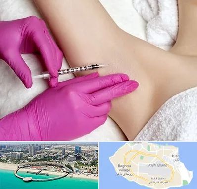 تزریق بوتاکس زیر بغل در کیش