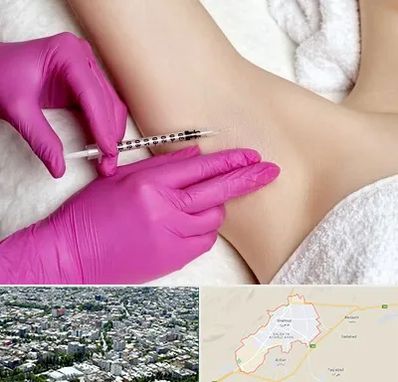 تزریق بوتاکس زیر بغل در شاهرود