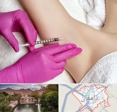 تزریق بوتاکس زیر بغل در دامغان