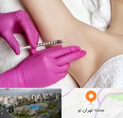 تزریق بوتاکس زیر بغل در تهران نو