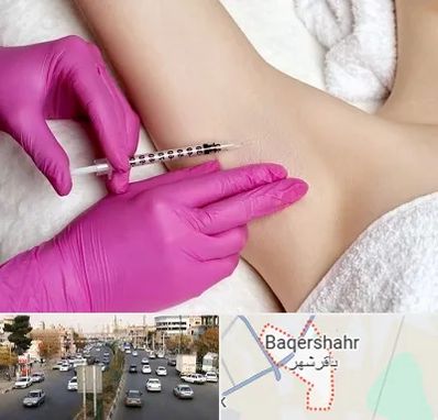 تزریق بوتاکس زیر بغل در باقرشهر