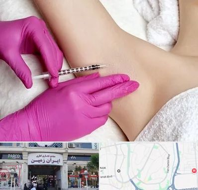 تزریق بوتاکس زیر بغل در ایران زمین