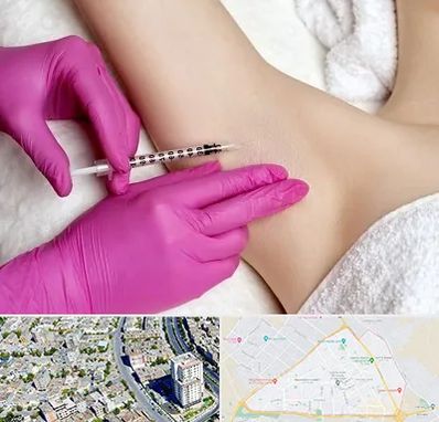 تزریق بوتاکس زیر بغل در قاسم آباد مشهد