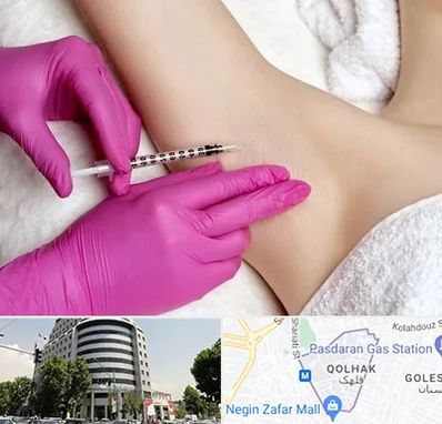 تزریق بوتاکس زیر بغل در قلهک 