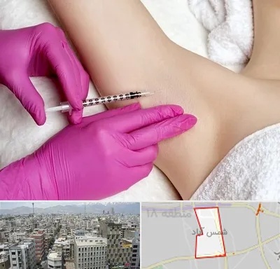 تزریق بوتاکس زیر بغل در شمس آباد تهران