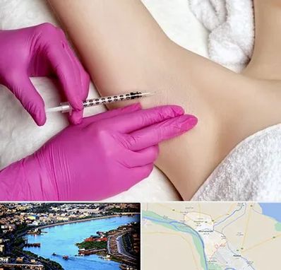 تزریق بوتاکس زیر بغل در خرمشهر