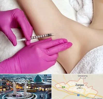 تزریق بوتاکس زیر بغل در زنجان