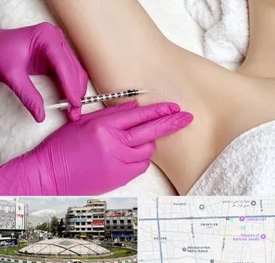 تزریق بوتاکس زیر بغل در مرکز تهران