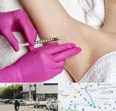 تزریق بوتاکس زیر بغل در قدوسی شرقی شیراز