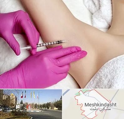 تزریق بوتاکس زیر بغل در مشکین دشت