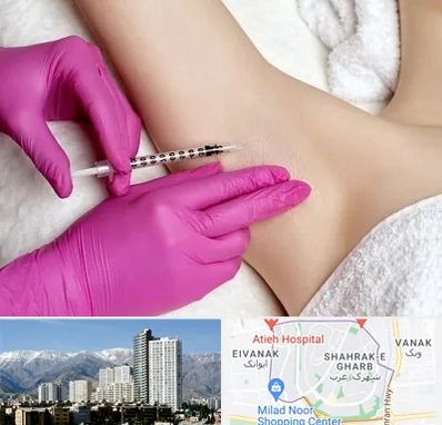 تزریق بوتاکس زیر بغل در شهرک غرب 