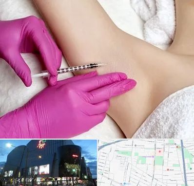 تزریق بوتاکس زیر بغل در بلوار اباذر