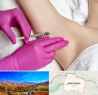 تزریق بوتاکس زیر بغل در خراسان شمالی