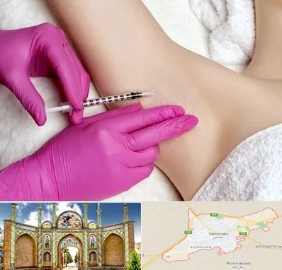 تزریق بوتاکس زیر بغل در سمنان