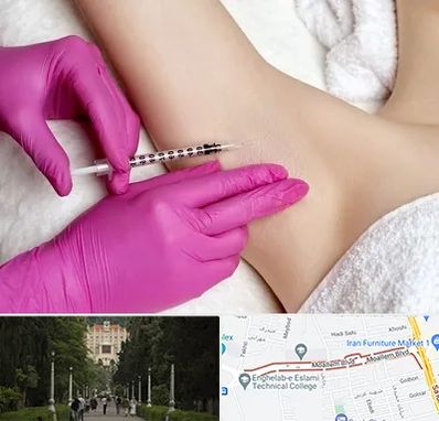 تزریق بوتاکس زیر بغل در بلوار معلم رشت 