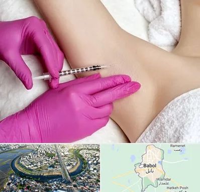 تزریق بوتاکس زیر بغل در بابل