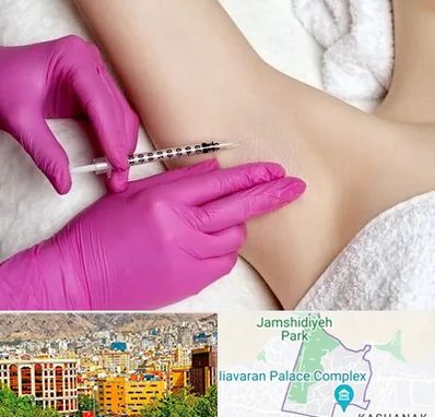 تزریق بوتاکس زیر بغل در نیاوران 