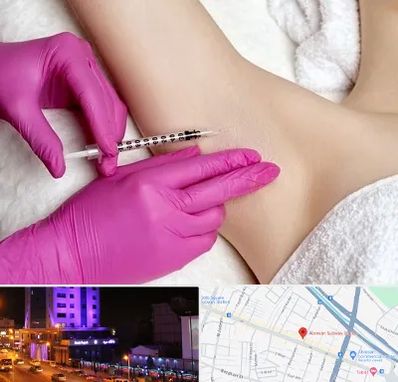 تزریق بوتاکس زیر بغل در آبرسان تبریز