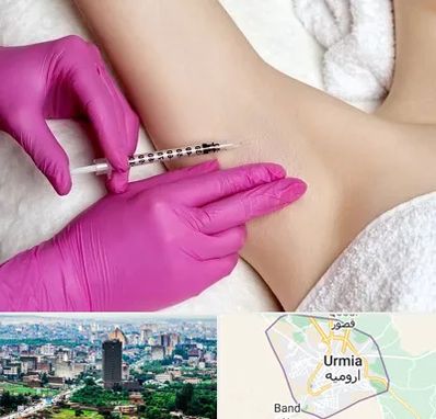 تزریق بوتاکس زیر بغل در ارومیه
