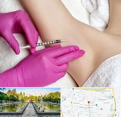 تزریق بوتاکس زیر بغل در سرسبز 