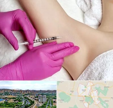 تزریق بوتاکس زیر بغل در شهریار